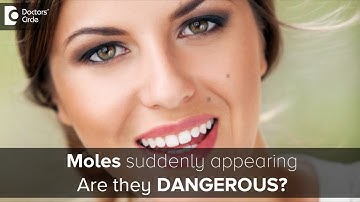 What causes moles to suddenly appear? How to know if they are dangerous? - Dr. Rasya Dixit